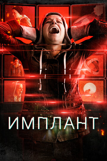 Имплант (2021)